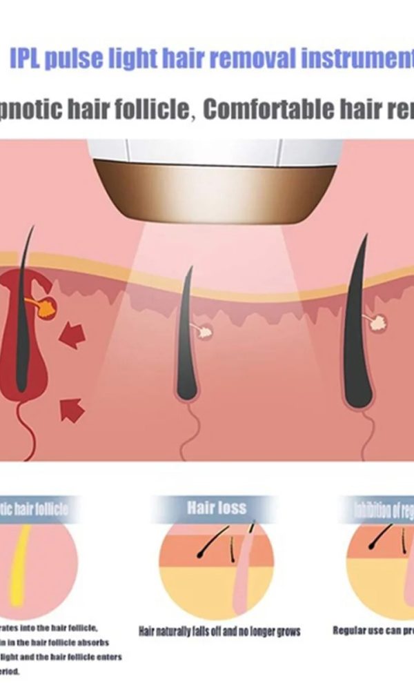 بهترین مرکز لیزر موهای زائد در اصفهان