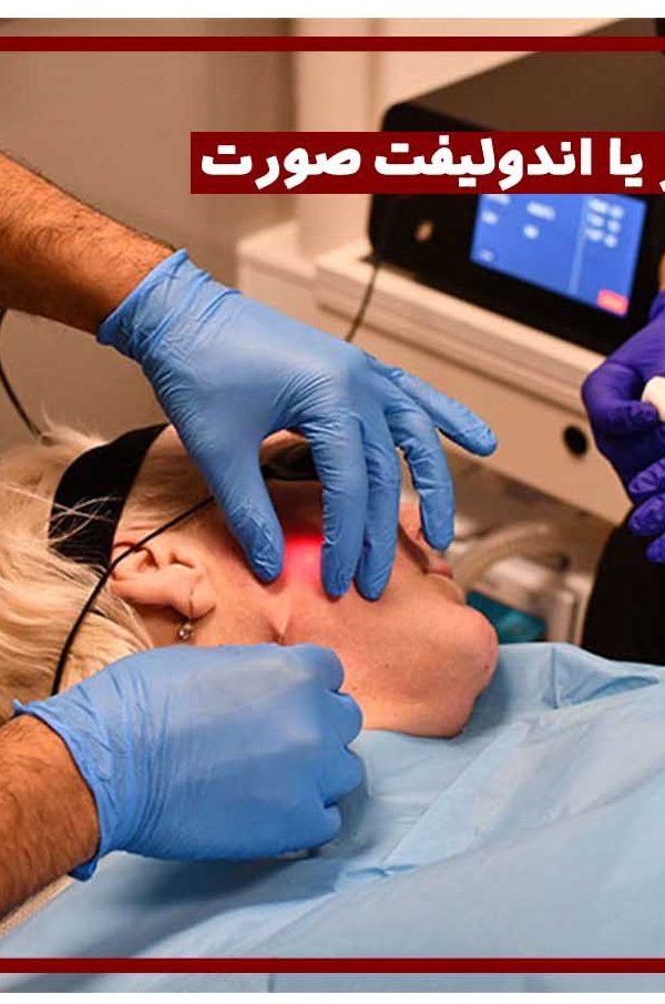 لیزر لیپولیز غبغب در اصفهان