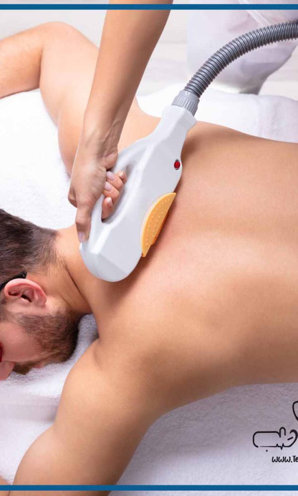 مرکز لیزر موهای زائد مردان در اصفهان