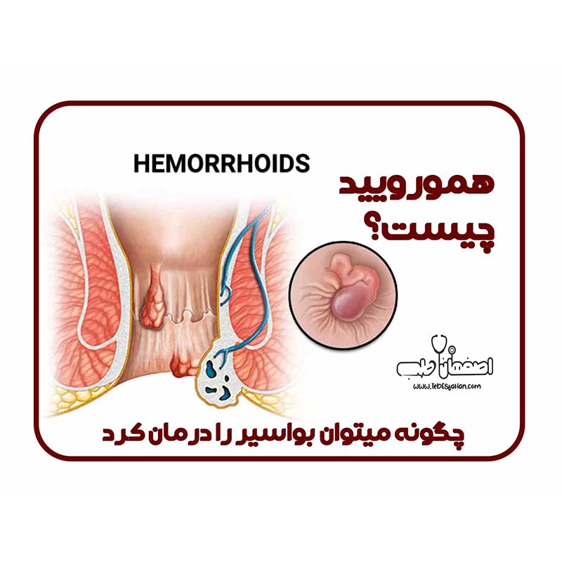 همورویید