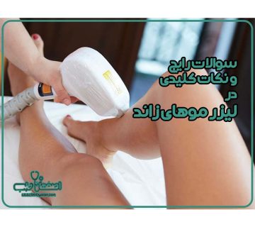 نکات لیزر مو