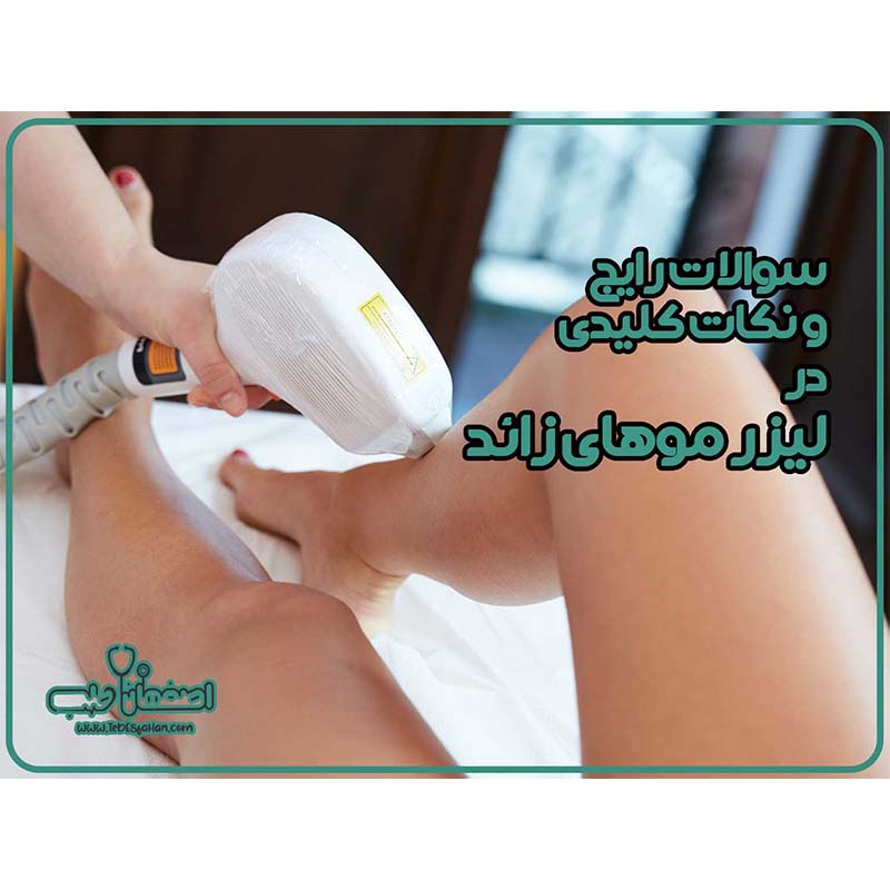 نکات لیزر مو