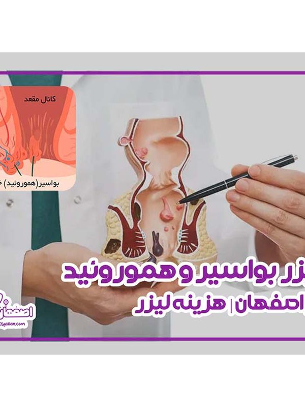 لیزر همورویید در اصفهان