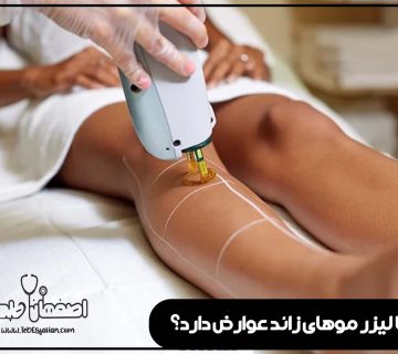 آیا لیزر موهای زائد عوارض دارد؟