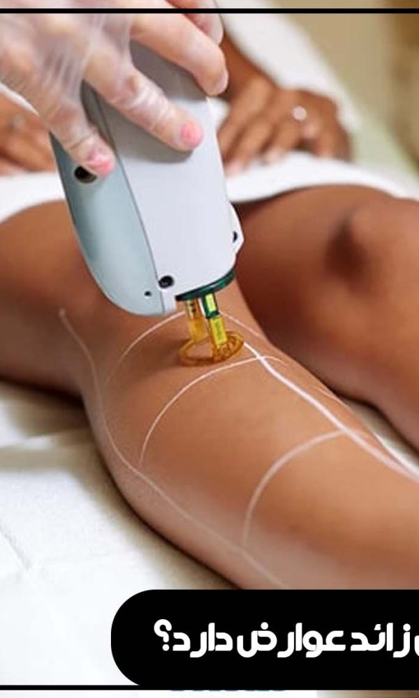 آیا لیزر موهای زائد عوارض دارد؟