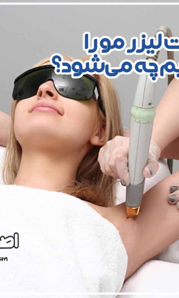 اگر جلسات لیزر مو را ادامه ندهیم چه می‌شود؟