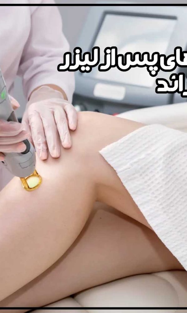 توصیه‌های پس از لیزر موهای زائد