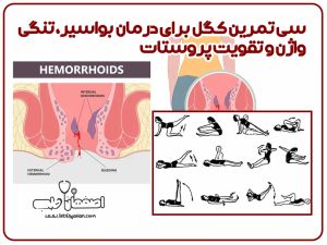 سی تمرین کگل برای درمان بواسیر، تنگی واژن و تقویت پروستات