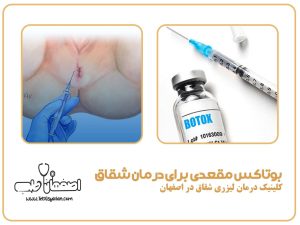 بوتاکس مقعدی برای درمان شقاق: درمان بدون جراحی و درد