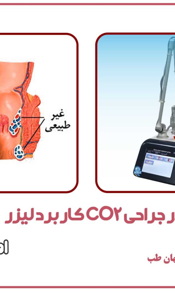کاربرد لیزر CO2 فرکشنال در جراحی همورویید