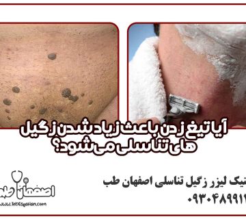 آیا تیغ زدن باعث زیاد شدن زگیل‌های تناسلی می‌شود؟