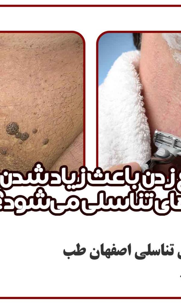 آیا تیغ زدن باعث زیاد شدن زگیل‌های تناسلی می‌شود؟