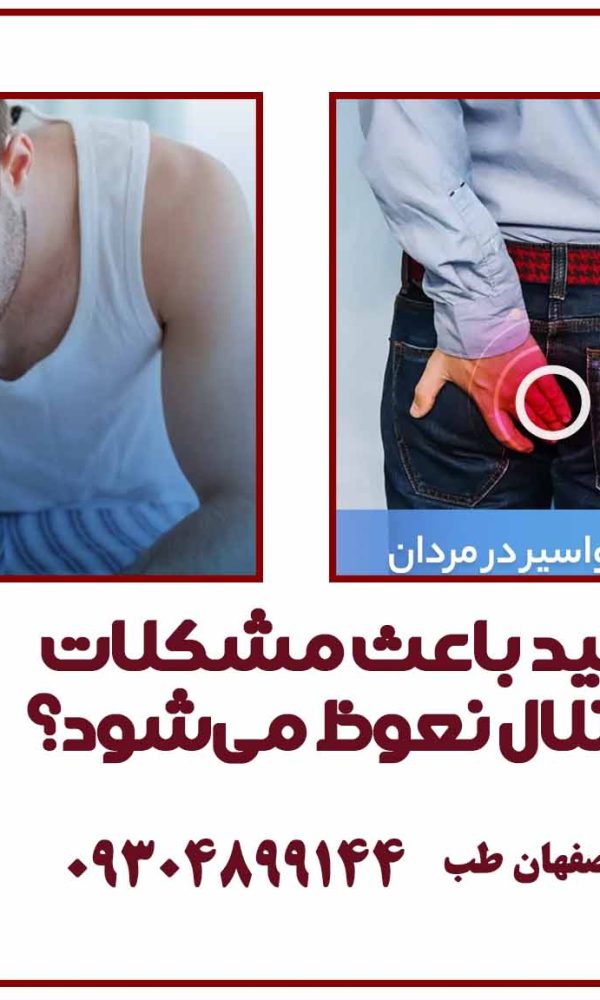 آیا هموروئید باعث مشکلات جنسی و اختلال نعوظ می‌شود؟