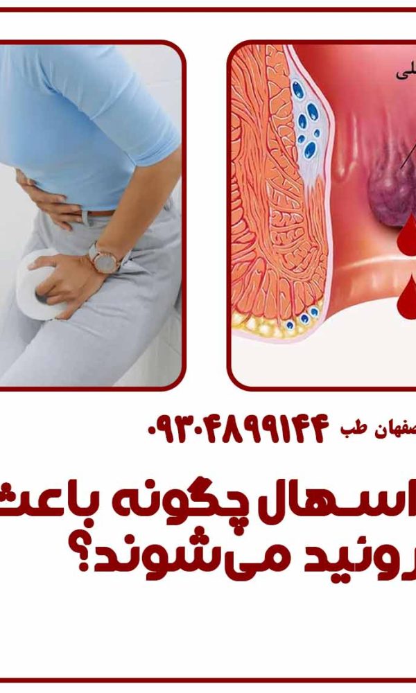 یبوست و اسهال چگونه باعث ایجاد هموروئید می‌شوند؟