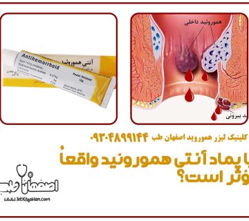 آیا پماد آنتی هموروئید واقعاً مؤثر است؟ تجربیات کاربران