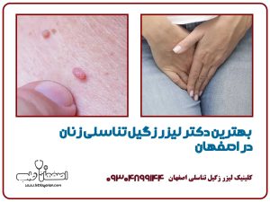 بهترین دکتر لیزر زگیل تناسلی زنان در اصفهان