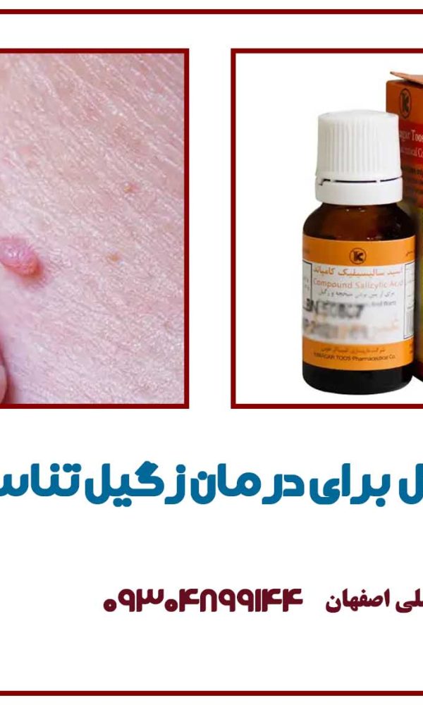 تاثیر محلول برای درمان زگیل تناسلی