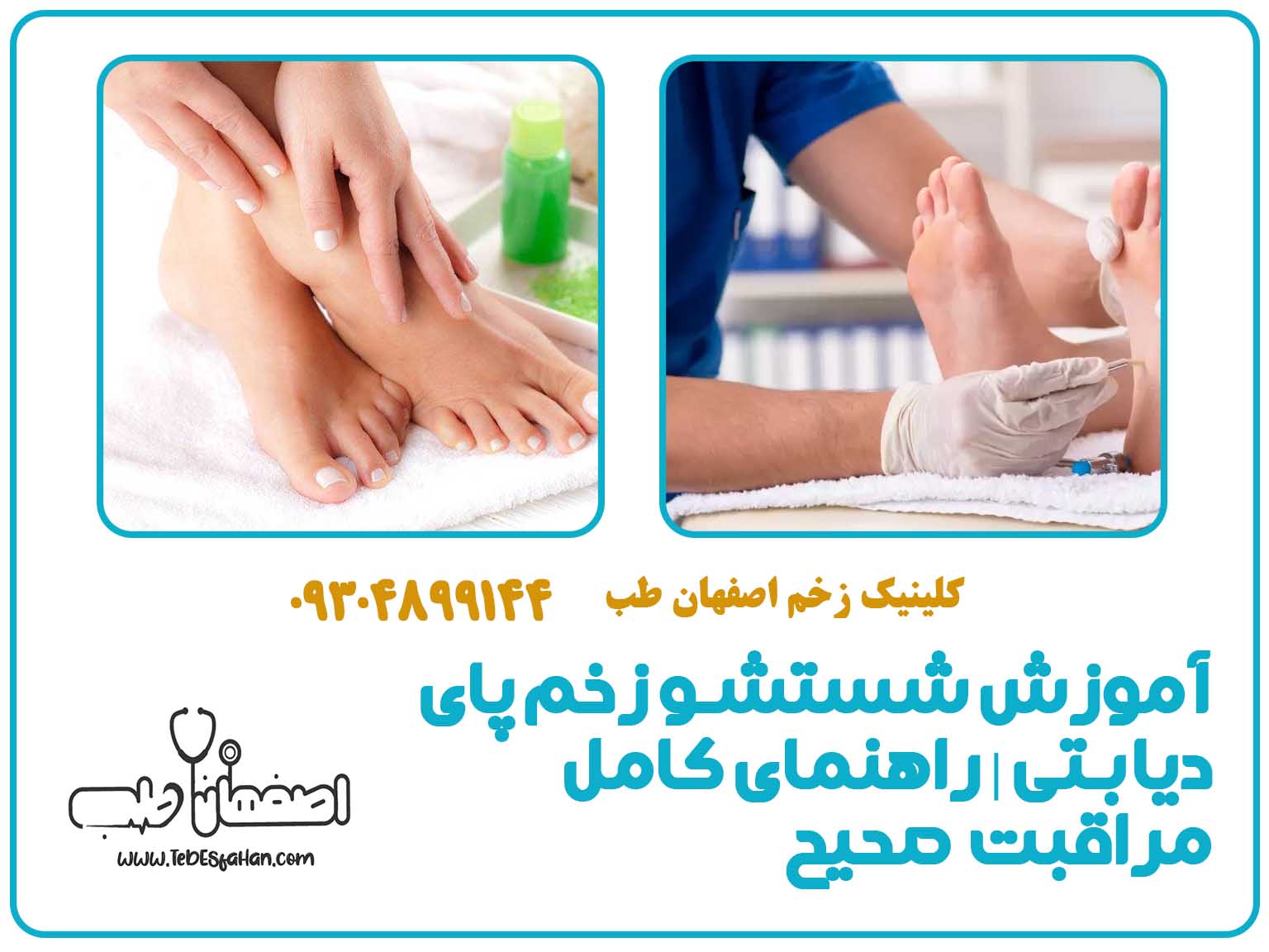 آموزش شستشو زخم پای دیابتی | راهنمای کامل مراقبت صحیح
