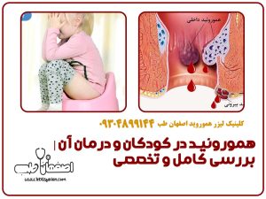 هموروئید در کودکان و درمان آن | بررسی کامل و تخصصی
