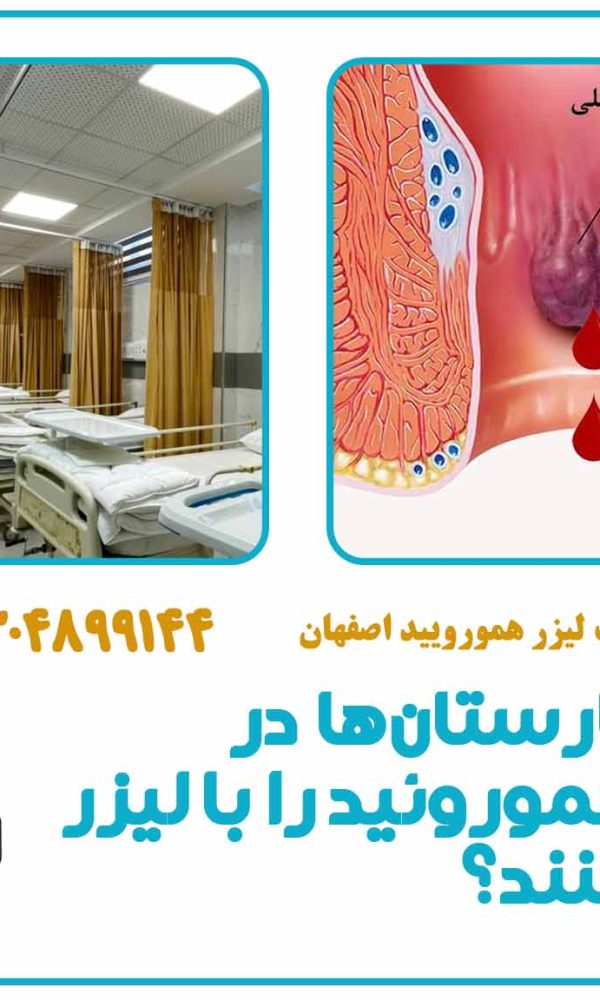 کدام بیمارستان‌ها در اصفهان هموروئید را با لیزر عمل می‌کنند؟