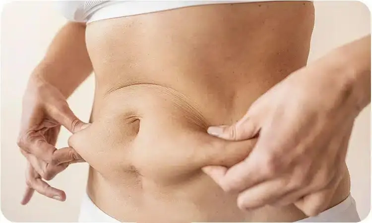 ابدومینوپلاستی در اصفهان