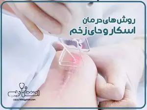 روش های درمان اسکار