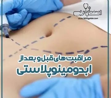 قبل و بعد از ابدومینوپلاستی