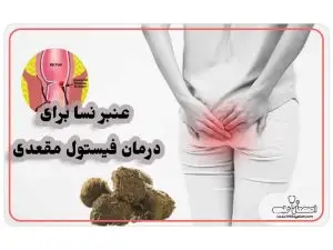 عنبرنسا در بواسیر