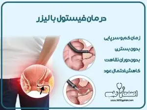 لیزر فیستول