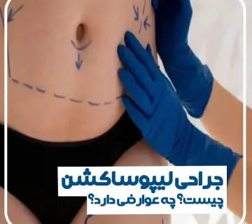 لیپوساکشن چیست