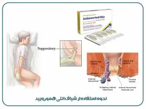 شیاف انتی همورویید
