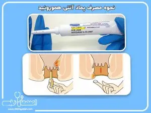 پماد آنتی هموروئید