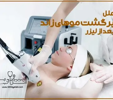 علت برگشت موهای زائد بعد از لیزر