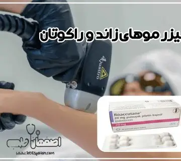 لیزر موهای زائد حین مصرف راکوتان