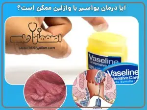 درمان همورویید با وازلین در منزل