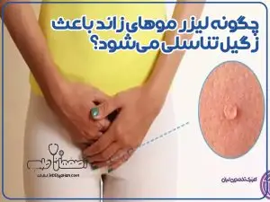 چگونه لیزر موهای زائد باعث زگیل تناسلی می‌شود؟
