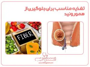 تغذیه مناسب برای جلوگیری از هموروئید