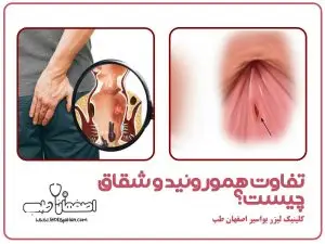تفاوت هموروئید و شقاق چیست؟