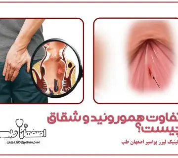 تفاوت هموروئید و شقاق چیست؟