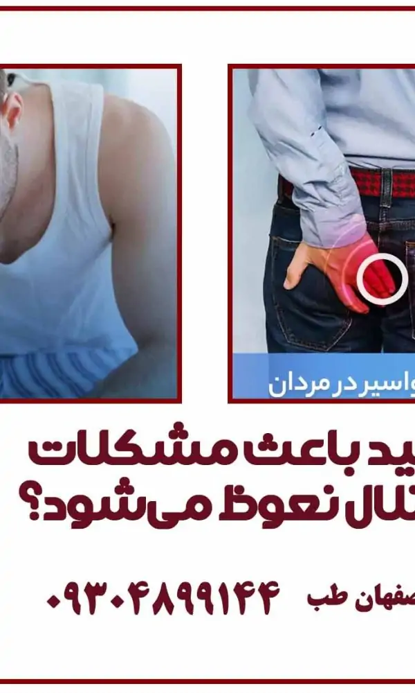 آیا هموروئید باعث مشکلات جنسی و اختلال نعوظ می‌شود؟