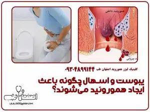 یبوست و اسهال چگونه باعث ایجاد هموروئید میشوند؟