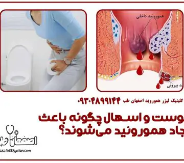 یبوست و اسهال چگونه باعث ایجاد هموروئید می‌شوند؟
