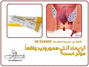 آیا پماد آنتی هموروئید واقعاً مؤثر است؟ تجربیات کاربران
