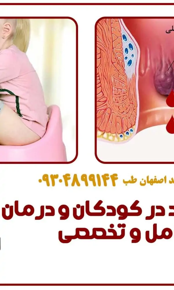هموروئید در کودکان و درمان آن | بررسی کامل و تخصصی