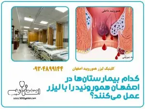 کدام بیمارستان‌ها در اصفهان هموروئید را با لیزر عمل می‌کنند؟