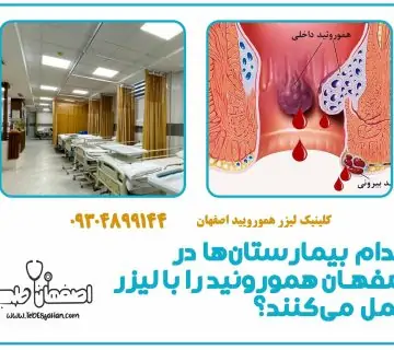 کدام بیمارستان‌ها در اصفهان هموروئید را با لیزر عمل می‌کنند؟