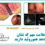 ۱۰ علامت مهم که نشان می‌دهد هموروئید دارید