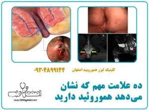 ۱۰ علامت مهم که نشان می‌دهد هموروئید دارید