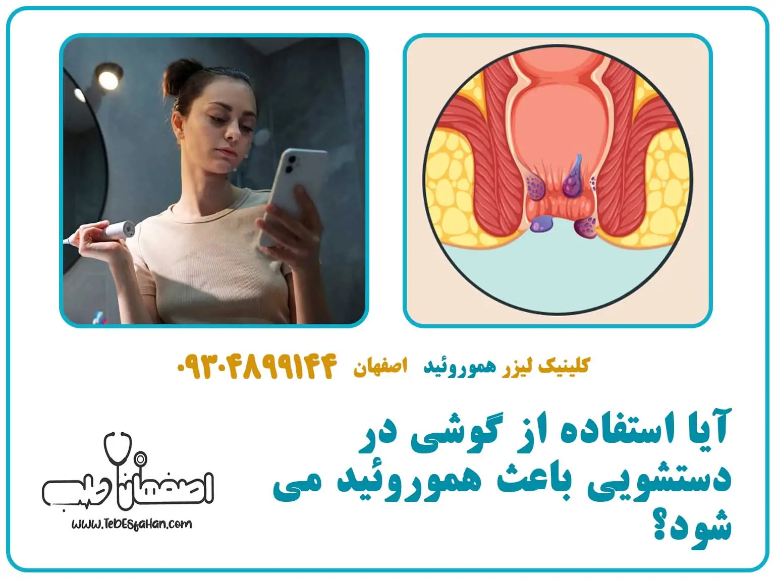 آیا استفاده از گوشی در دستشویی باعث هموروئید میشود؟