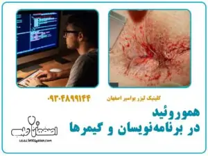 هموروئید در برنامه‌نویسان و گیمرها